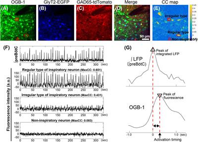 Cell Type-Dependent Activation Sequence During Rhythmic Bursting in the PreBötzinger Complex in Respiratory Rhythmic Slices From Mice